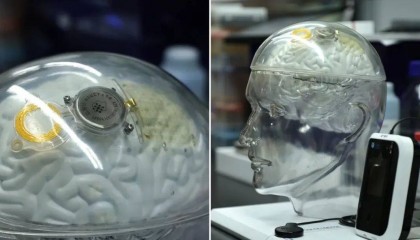 美媒详细介绍中国“脑机接口”技术进展:“起步晚美国20年,中国迅速赶上!”