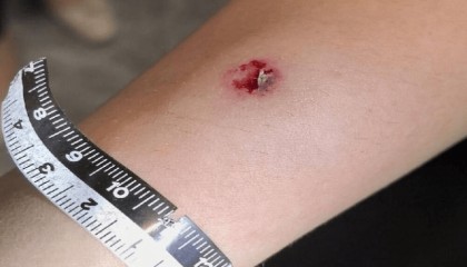 杭州警方通报:4名伤者均为女性