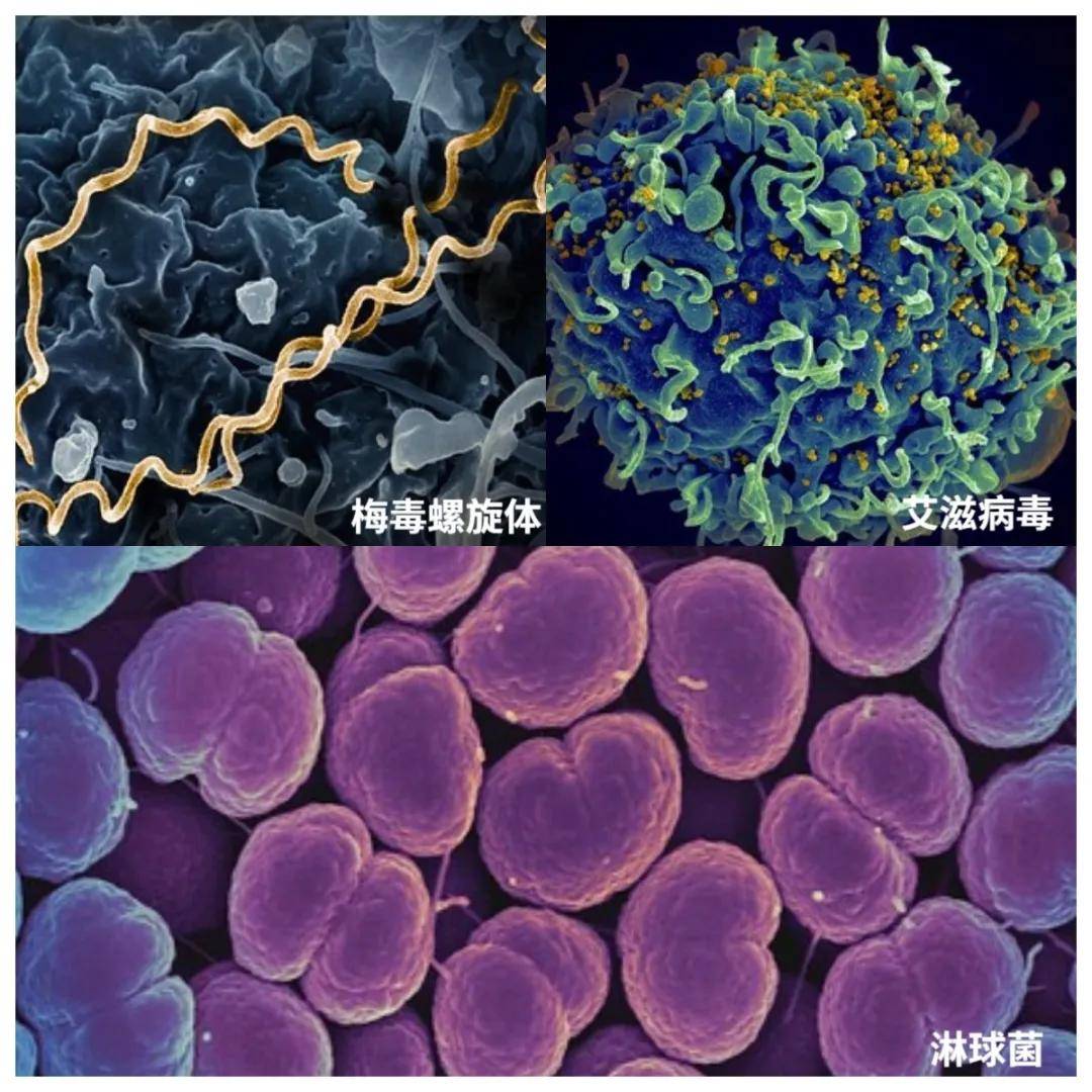 整个商场找不到一个蹲便,蹲厕真的比坐厕更卫生吗?为啥马桶越来越多?